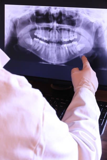 Best Emergency Dental Care for Broken or Chipped Teeth in Green Knoll, NJ